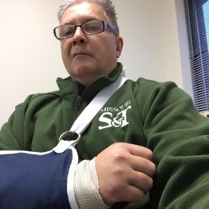 Me, about four days after fracturing my right elbow